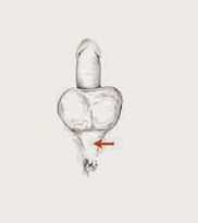 שרירי העוצמה והמתח שלהם להגברת העוצמה